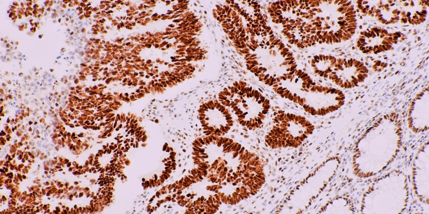 İmmunohistokimya Analizleri - Otto Bilimsel