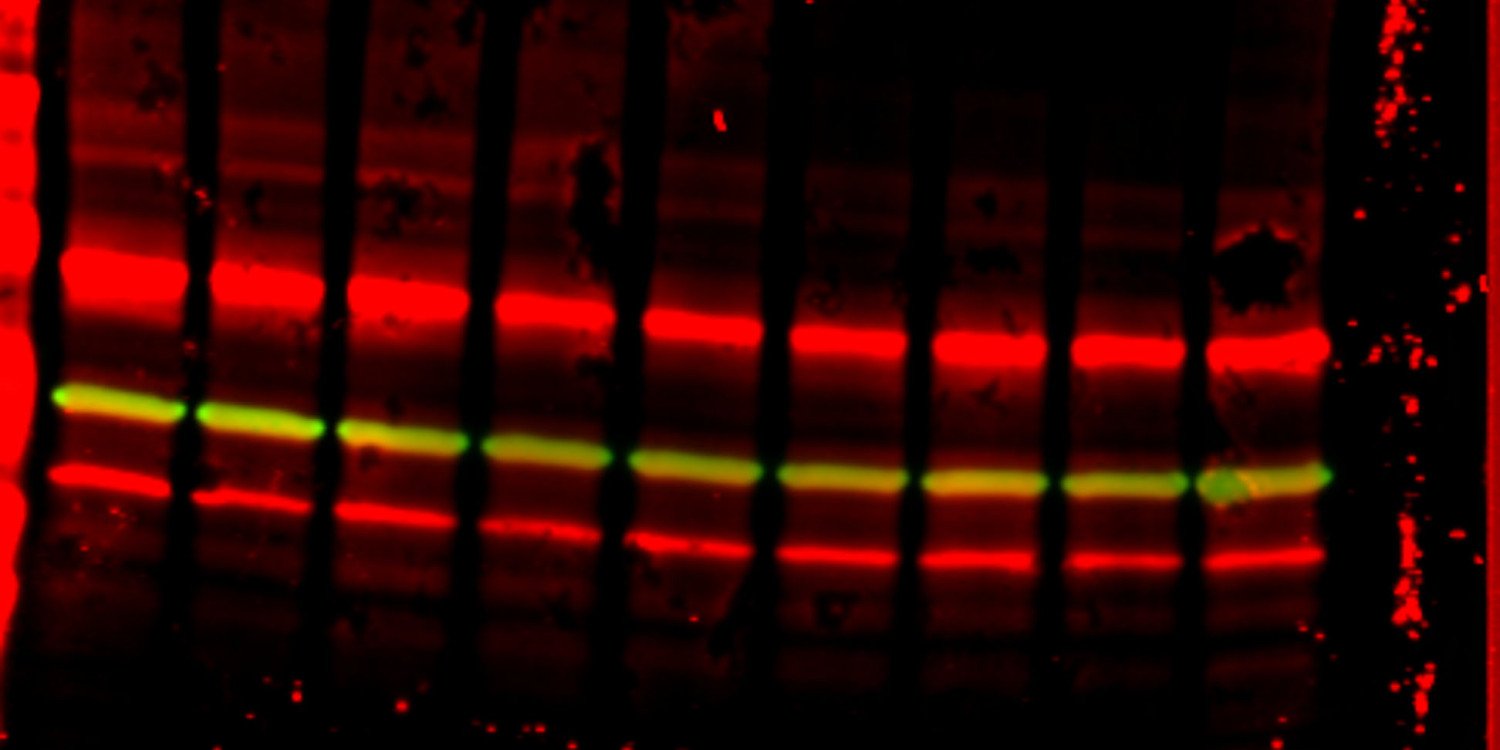 Western Blot Analizleri - Otto Bilimsel