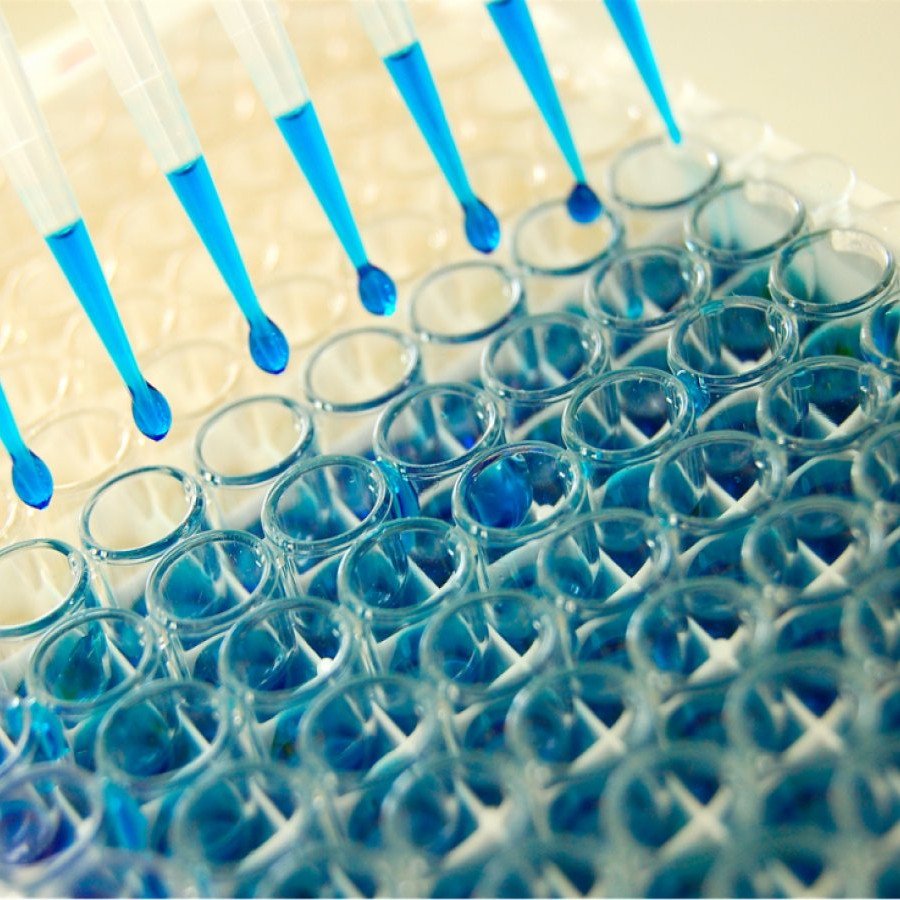 Tumor Necrosis Factor Alpha (TNF-α) Elisa Test Kiti - Otto Bilimsel